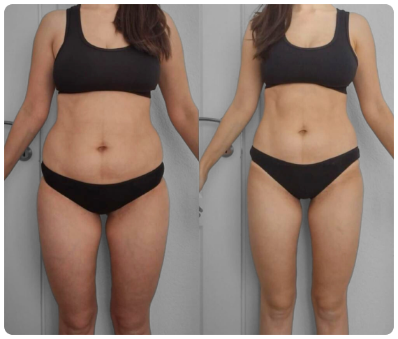 transformacija-4