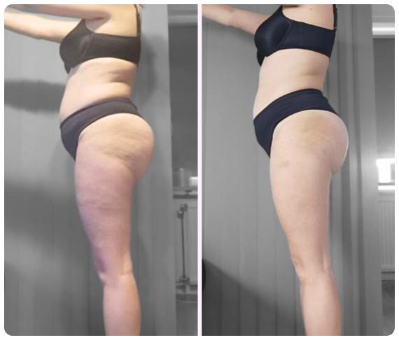 transformacija-5
